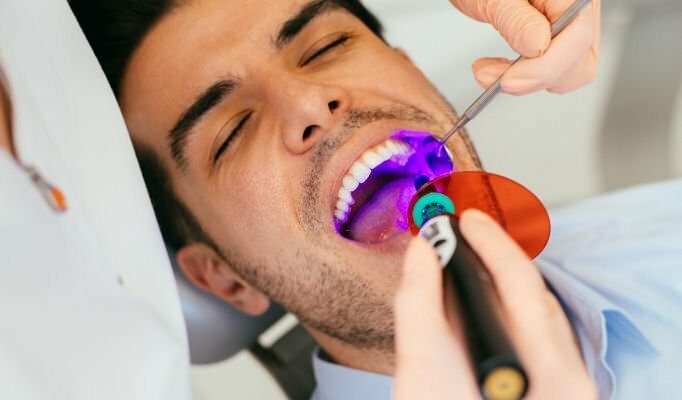 Dental Sealant Procedure: Fillings That Prevent Cavities