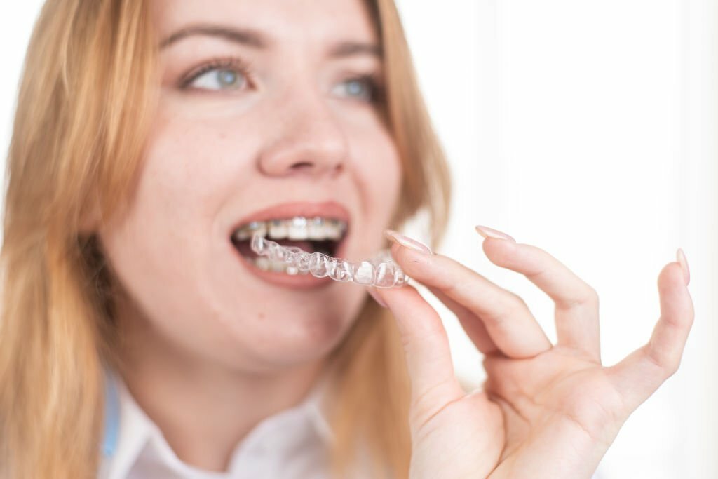 Everything You Need To Know About Invisalign In Frisco, TX