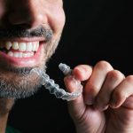 Everything You Need To Know About Invisalign In Frisco, TX_FI