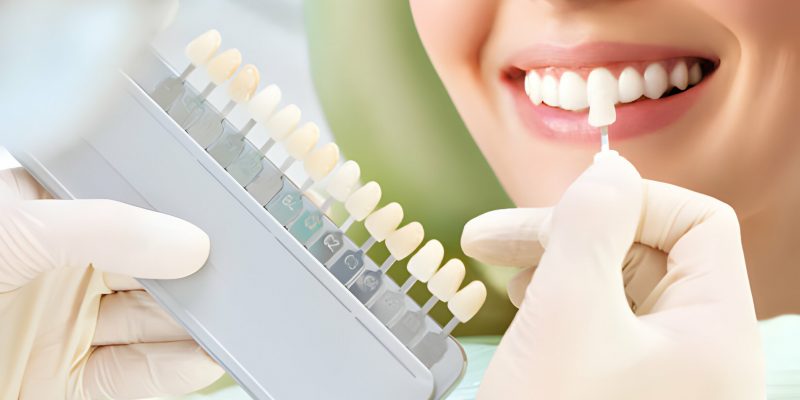 10 Tips for Choosing the Right Cosmetic Dentist in Frisco_FI