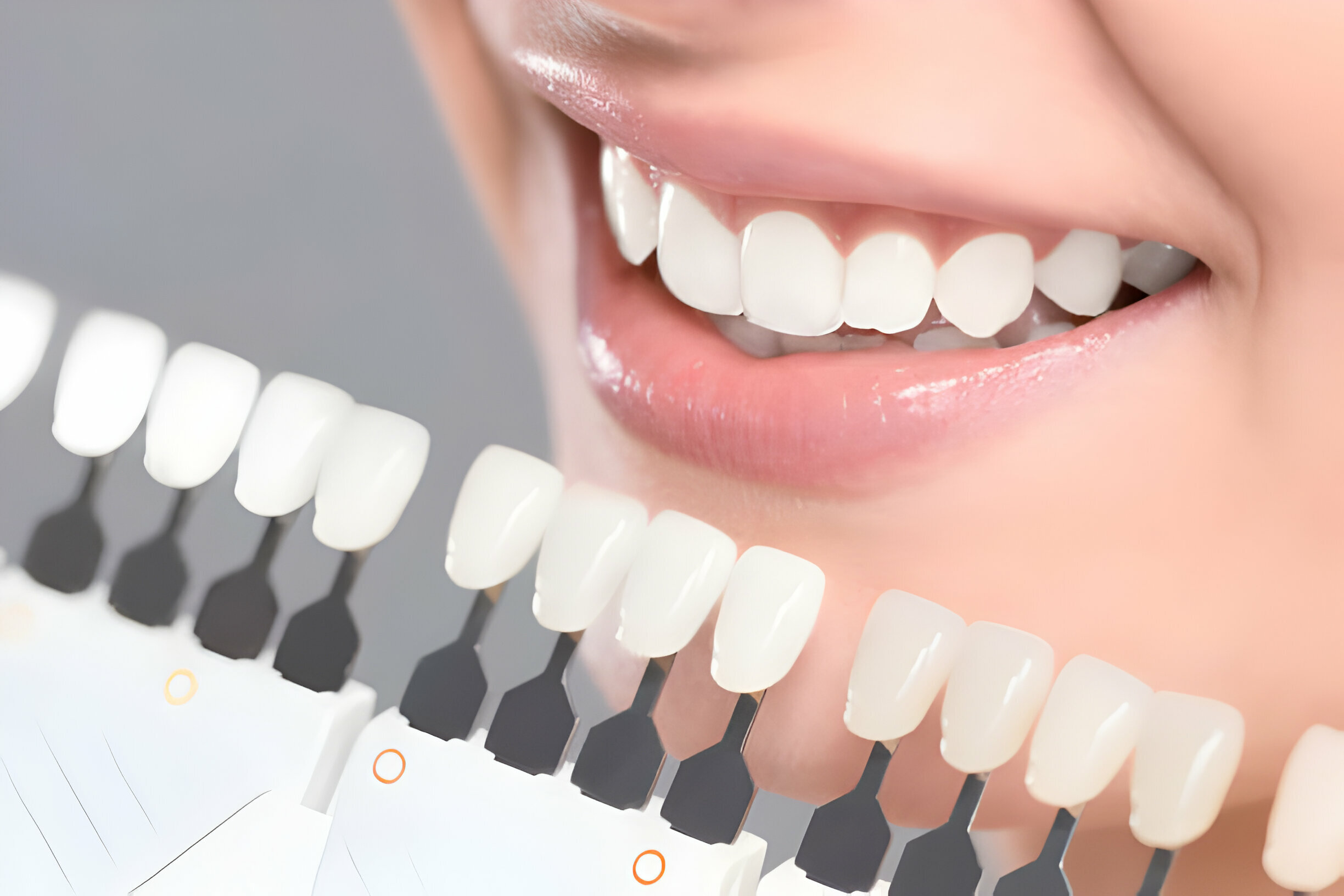 Enhancing Your Dental Aesthetics: Cosmetic Dentistry Trends in Frisco_3