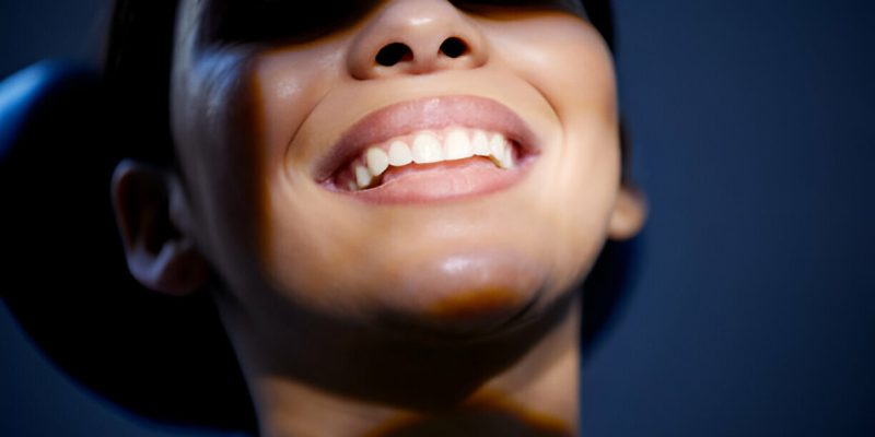 Teeth Whitening in Frisco, TX: Brighten Your Smile at Dental Arts of Frisco_FI